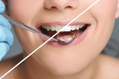 Dental Cleaning and Exams vs Full Dental Checkup: What’s the Real Difference?