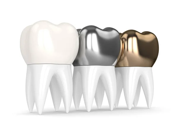 Comprehensive Step-by-Step Overview of the Dental Crowns Procedure in Denver CO