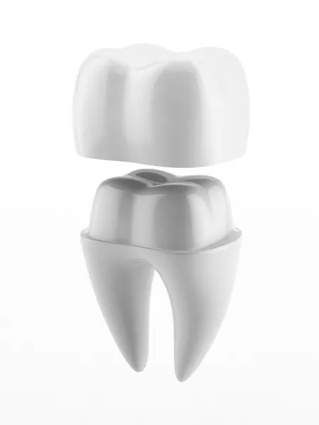 Discover Durable Dental Crowns in Denver CO for Lasting Smiles at Geis Dentistry